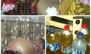Asmani Berhasil Dioperasi, Cairan Perut 6 Botol. Donasi Tembus Rp 22 Juta