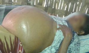 Terbongkar, Penderita Kanker Hati, Asmani Makan Tak Layak saat Jadi TKW