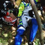 Cedera Patah Tulang, Bupati Bangkalan Sudah Selesai Di Operasi