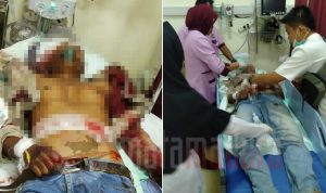 Ternyata, Asis Dibacok 8 Orang di Depan Anaknya Sendiri