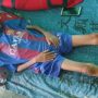 Kisah Pilu Malik; Anak Yatim Piatu di Bangkalan Terbaring Lemas Akibat Gizi Buruk