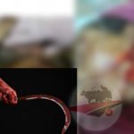 Seperti Kesurupan, Lengan Petani Giliyang Dipotong Hingga Telinga Nyaris Putus