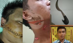 Kakak Beradik di Sumenep Aniaya Dua Pemuda Pakai Sajam, Mulut Korban Robek