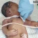 Petugas Medis Sebut Bayi Perempuan dalam Kardus di Blega Meninggal 3 Sebelum Penemuan