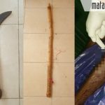 Gara-Gara Batas Tanah, Dua Orang Bersaudara di Sapudi Berkelahi hingga Luka-Luka