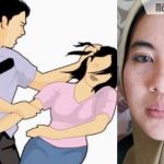 Diduga Dianiaya Pak Kades, Wanita Cantik di Sumenep Lapor Polisi