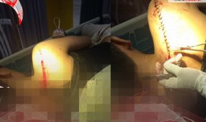 Gegara Sepele, Pengunjung Taman Wiyata Sampang Dibacok